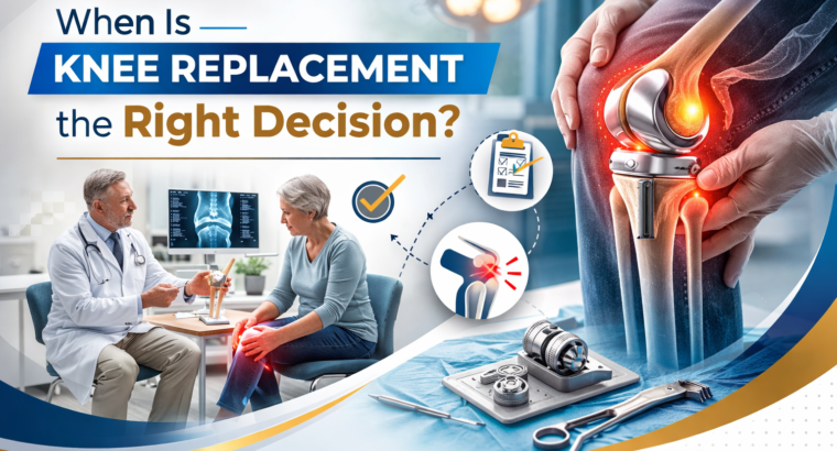 When Is Knee Replacement the Right Decision?